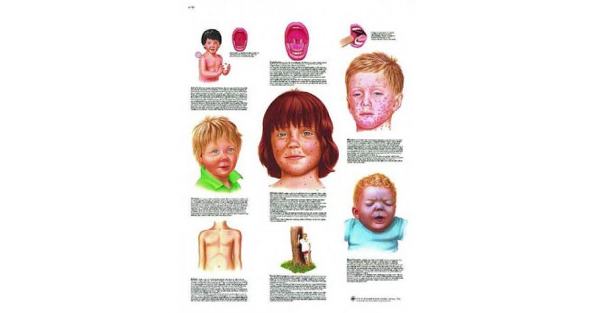 Poster Les Maladies Infantiles