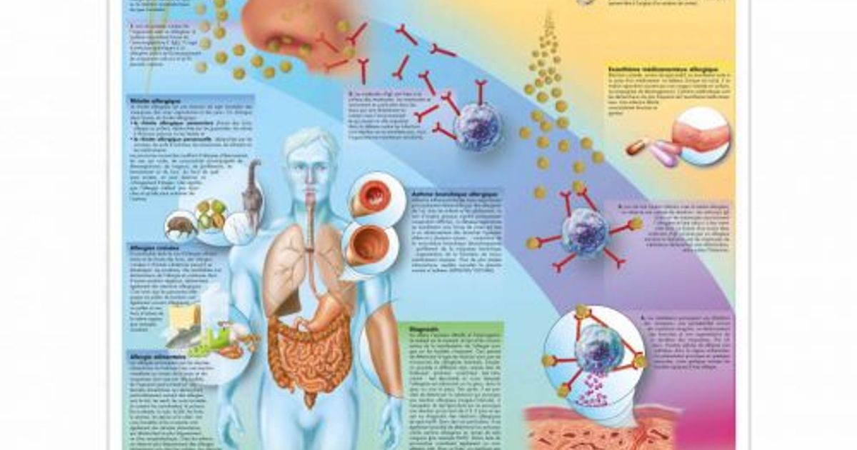 Poster Allergies
