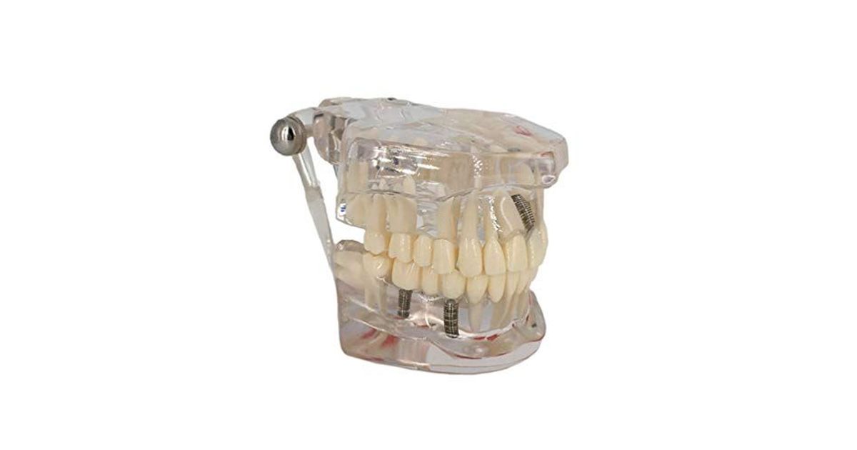 Complete Dental Lab Model